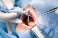 Beredar Kabar Pasien Meninggal Jelang Operasi Gigi, RSHS Bandung Akhirnya Buka Suara. (Ilustrasi)