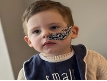 Alami GTM Hingga Setahun Lebih, Bocah Ini Terpaksa Makan Pakai Selang   