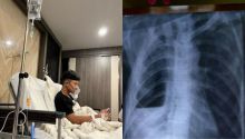 Viral Pria 18 Tahun di Klaten 4 Kali Masuk RS usai Ngevape-Rokok  
