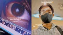 Curhat Pemuda 21 Tahun Transplantasi Kornea gegara Rabun Imbas Sering Kucek Mata