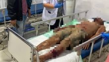 Korban UT saat terbaring di RSUD Mandau