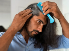 Mitos transplantasi rambut dibantah oleh pakar /Freepik 