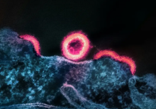 Mikroorganisme infeksius/ Institut Nasional Alergi dan Penyakit Menular-Unsplash